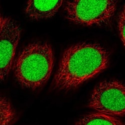 XPC Antibody, Novus Biologicals:Antibodies:Primary Antibodies